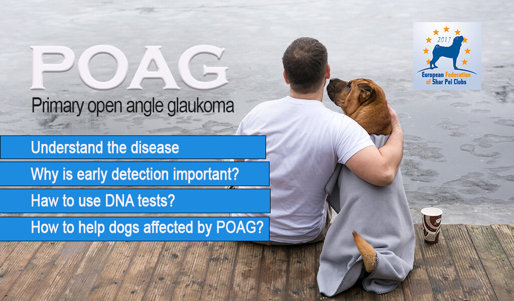 Primary open angle glaucoma – POAG